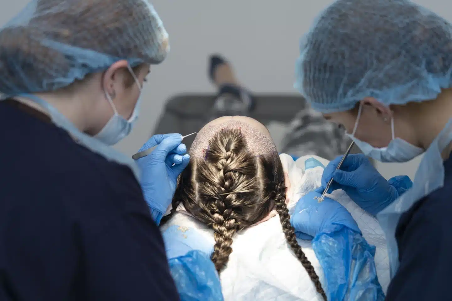 Hair transplant surgery process