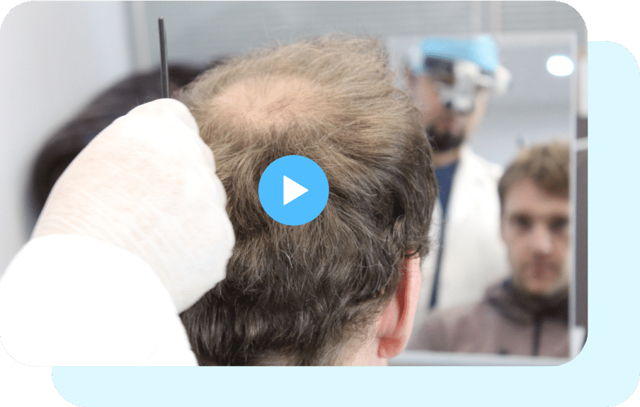Welcome to the Hair Dr | Hair Transplant Clinic | FUE Transplant