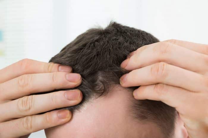 hair transplant Clinic