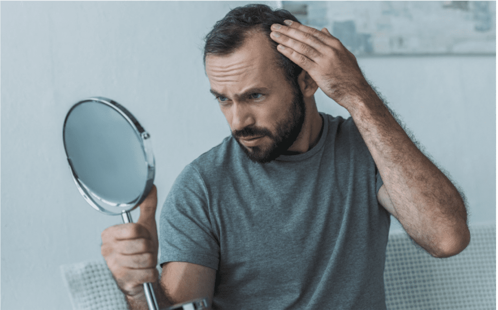 who is suitable for hair loss treatment