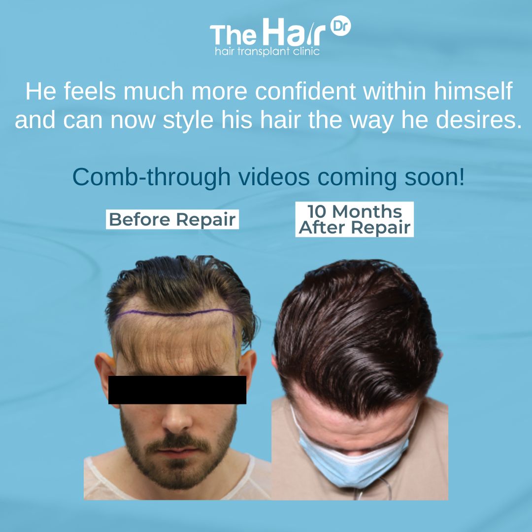 Results - The Hair Dr