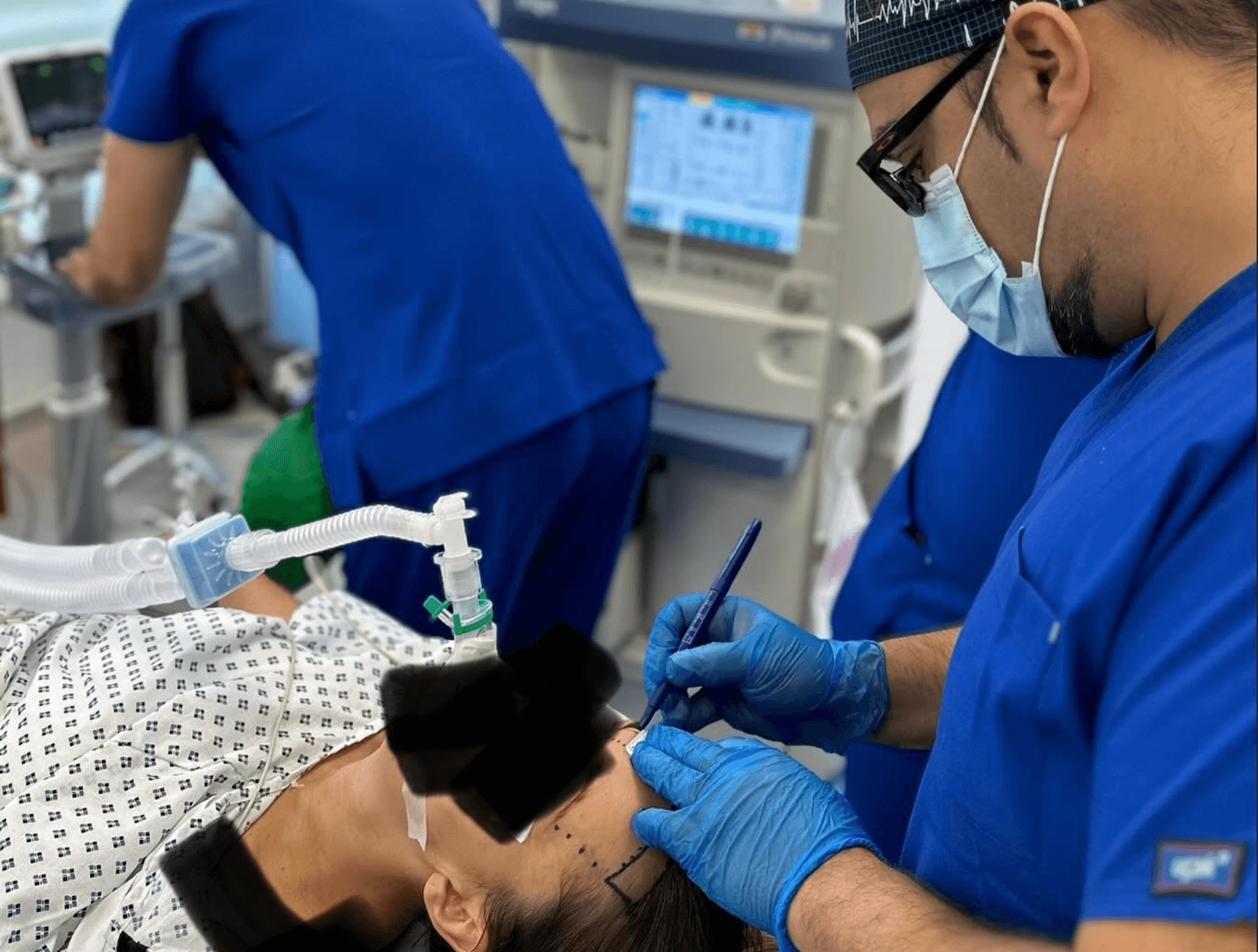 Forehead Reduction Leeds