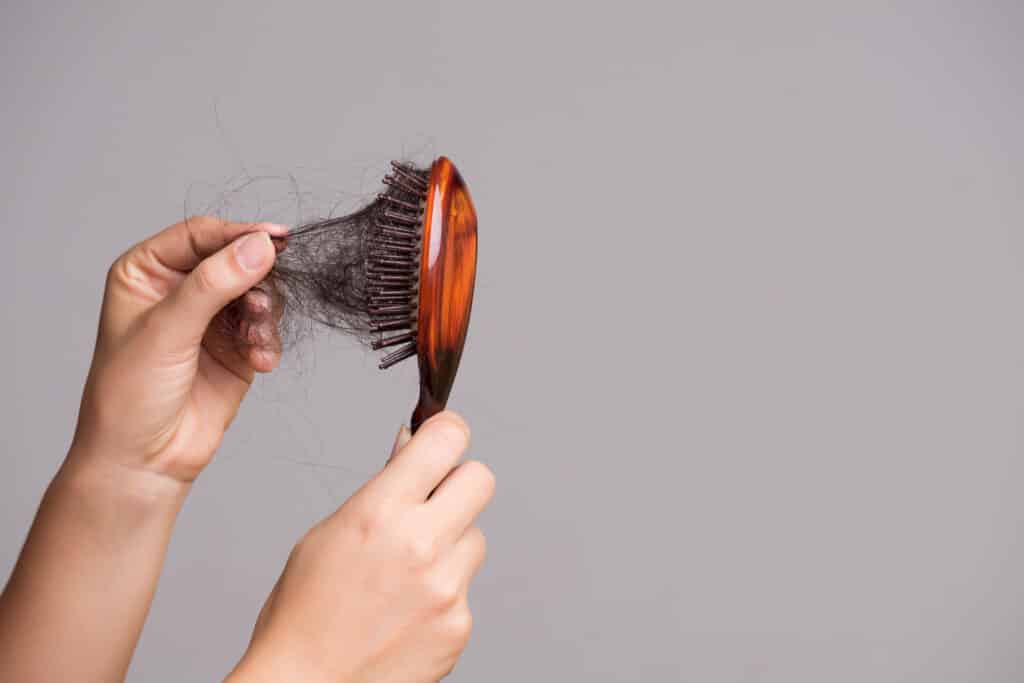 Direct Hair Implant For Women: A Permanent Hair Loss Solution Women Embrace